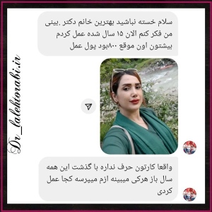 جراحی-بینی-89