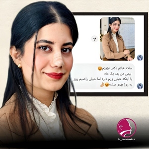 جراحی-بینی-91