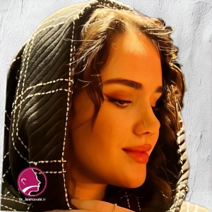 جراحی-بینی-93