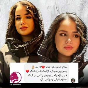 جراحی-بینی-94