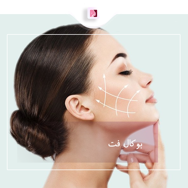 بوکال فت در رشت - دکتر لاله ترابی