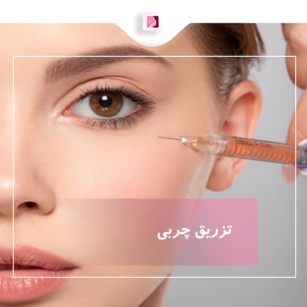 تزریق چربی در رشت - دکتر لاله ترابی