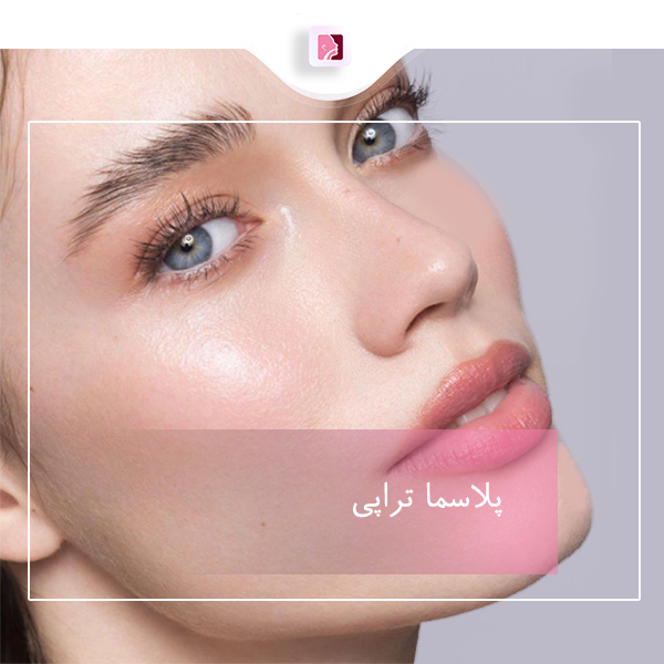 پلاسما تراپی - دکتر لاله ترابی در رشت