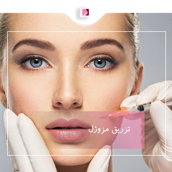 تزریق مزوژل در رشت - دکتر لاله ترابی