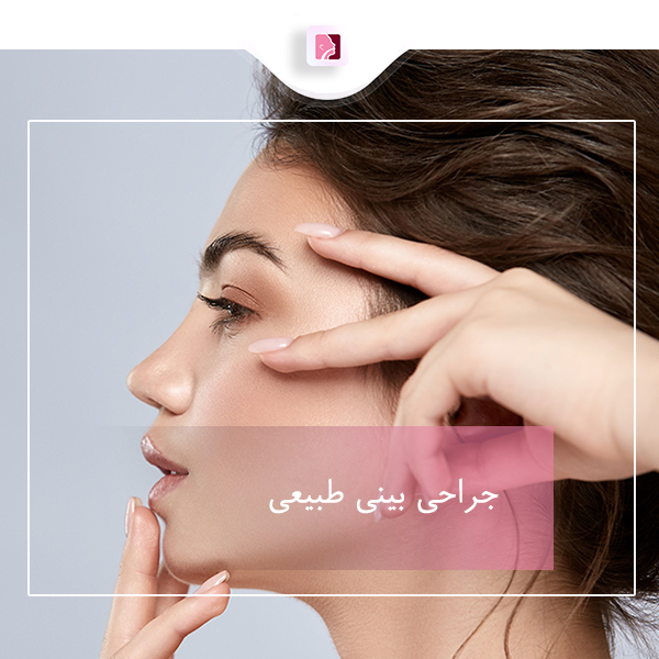 جراحی بینی طبیعی در رشت - دکتر لاله ترابی