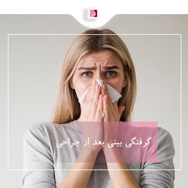 گرفتگی بینی بعد از جراحی - دکتر لاله ترابی در رشت