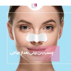 چسب زدن بینی بعد از جراحی