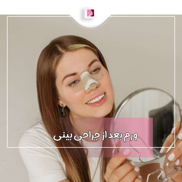 ورم بعد از جراحی بینی