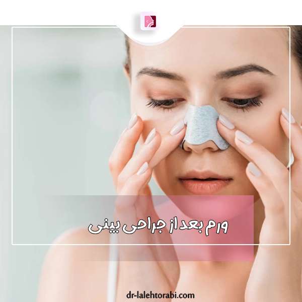 ورم بعد از جراحی بینی