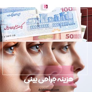 هزینه جراحی بینی - دکتر لاله ترابی